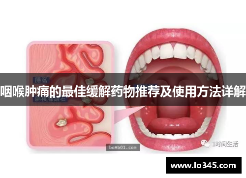 咽喉肿痛的最佳缓解药物推荐及使用方法详解